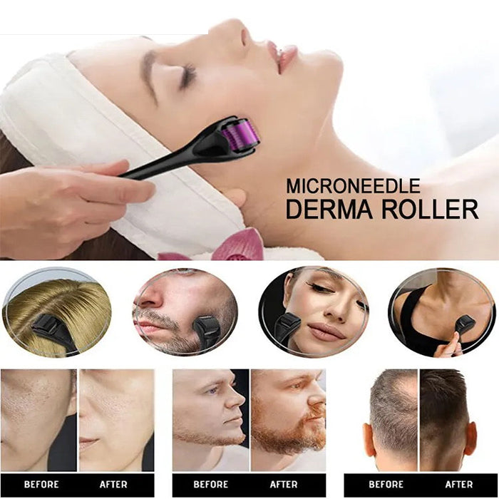 Derma Roller, Needle Roller - Anti-Ageing System transformation