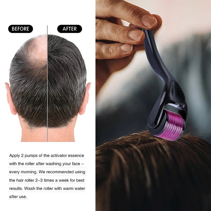 Derma Roller, Needle Roller - Anti-Ageing System with 540 Needles 0.50mm For Hair