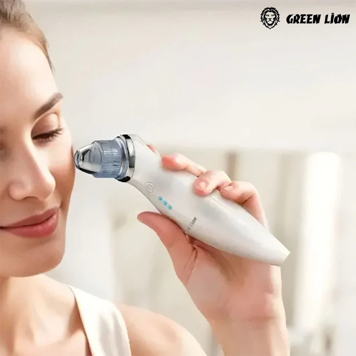 Close-up of blackhead and whitehead removal using suction device for clear skin results in  Homesouq Qatar